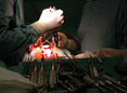Komoly orvosi szerszámkészletet igénylő műtétek